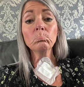 Claire - diagnosed with skin cancer