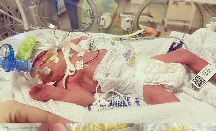Susie fights for live in Leighton NICU