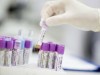 Low testosterone and inflammation: Hidden link in men’s health