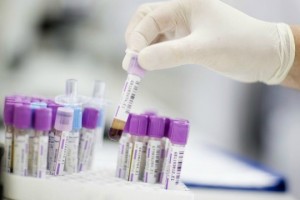Low testosterone and inflammation: Hidden link in men’s health